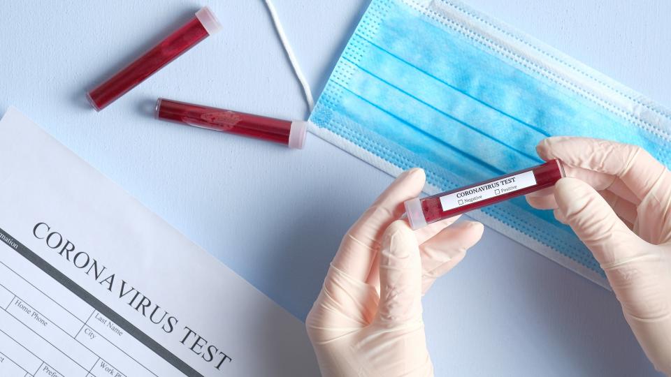 Zwei behandschuhte Hände halten ein Blutprobe. Dahinter ein Formular "Coronavirus Test" und eine medizinische Maske.