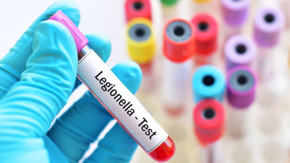 Eine Person trägt Schutzhandschuhe und hält dabei ein Reagenzglas mit der Aufschrift "Legionella - Test" in einer Hand. Im Hintergrund befinden sich noch weitere Reagenzgläser.
